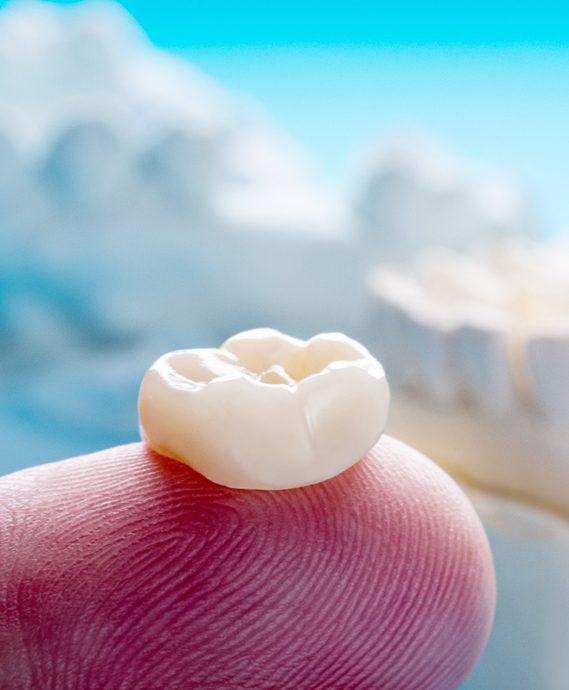 Dental crown on fingertip with casts of jaws in background