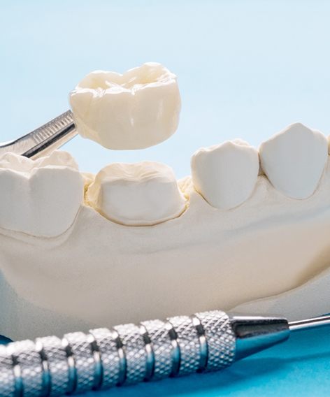Dental crown held over model tooth next to dental instrument