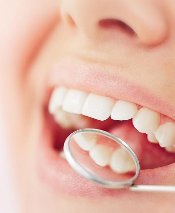 Nose-to-mouth closeup of someone smiling with dental mirror reflecting upper teeth